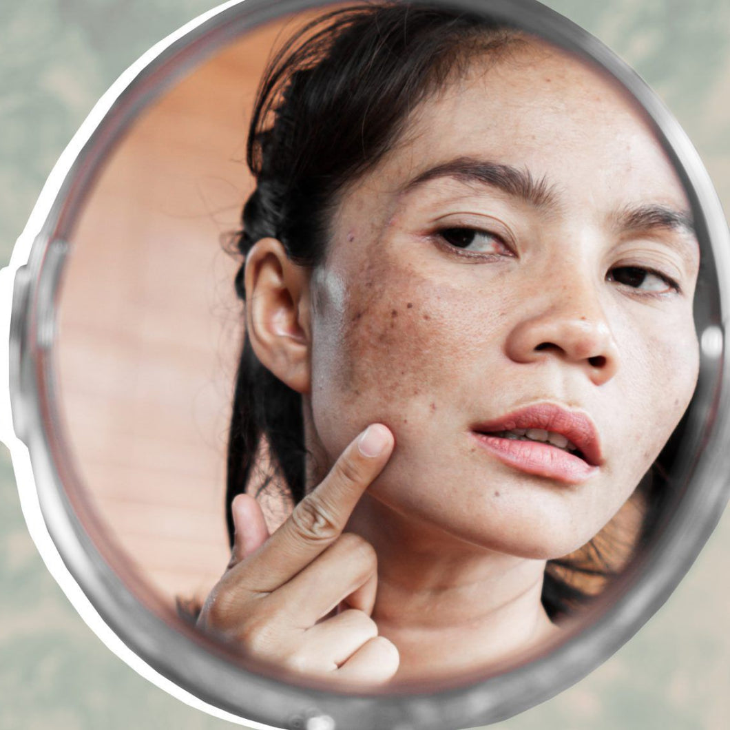 Dark Spots & Melasma Treatment Plan - r